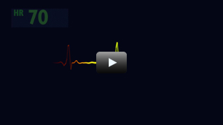 HEART
RATE MONITOR